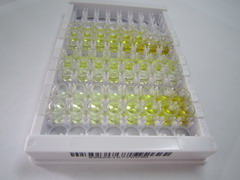 无翅型MMTV整合位点家族成员9B(WNT9B)检测试剂盒(酶联免疫吸附试验法)