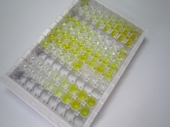三角形四肽重复域蛋白39B(TTC39B)检测试剂盒(酶联免疫吸附试验法)