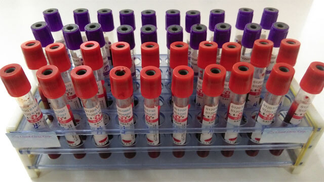 Serums Customized Service