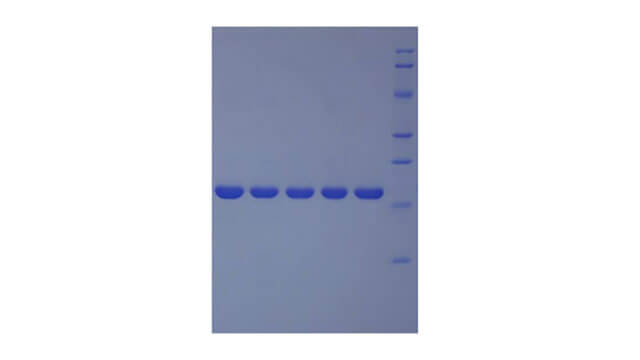Polyacrylamide Gel Electrophoresis (PAGE) Experiment Service