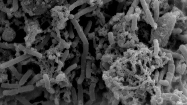 Scanning Electron Microscope (SEM) Experiment Service