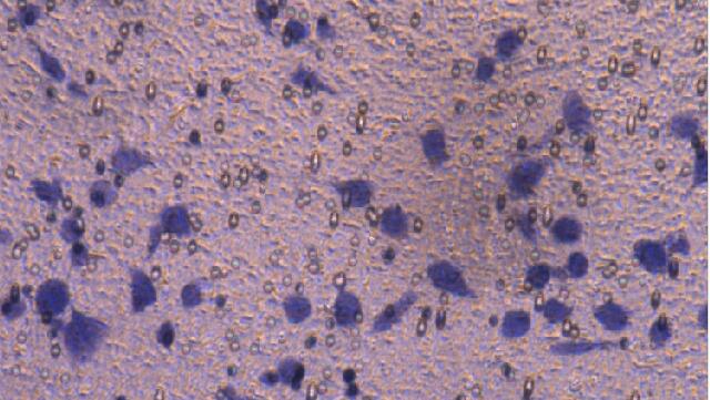 Cell Invasion Assay Service