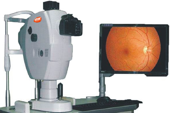 山羊视网膜影像系统LAI043