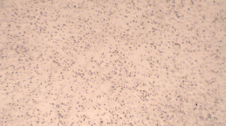 小鼠骨髓间充质干细胞bmmscs原代细胞