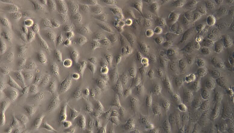 食管内皮细胞图片图片
