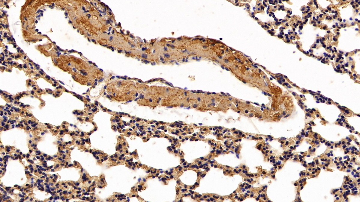 夏科雷登氏结晶蛋白(clc)多克隆抗体