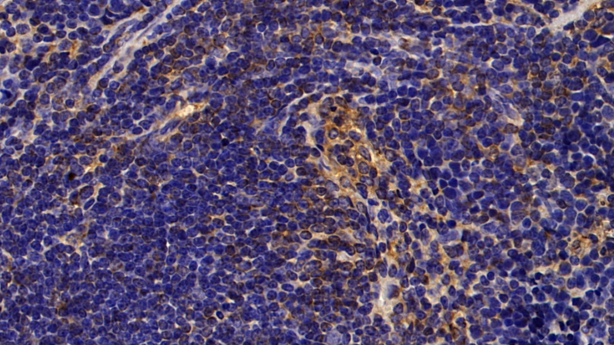 夏科雷登氏结晶蛋白(clc)多克隆抗体